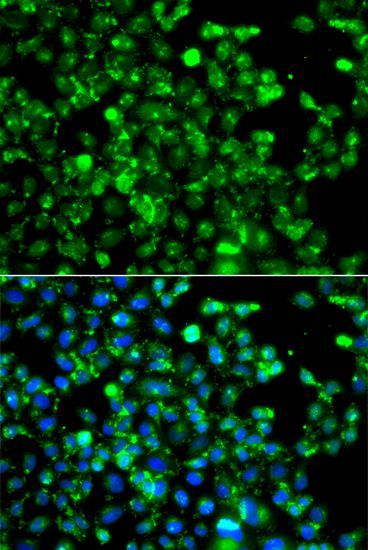 Immunofluorescence - CAPN5 antibody (144-07428)