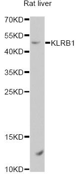 Western blot - KLRB1 Polyclonal Antibody (144-61444)