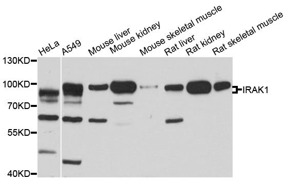 Western blot - IRAK1 antibody (144-600844)