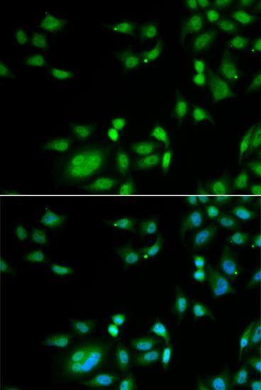 Immunofluorescence - INTS10 antibody (144-013419)