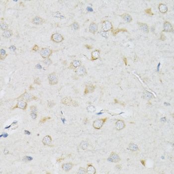 Immunohistochemistry - SLC2A13 Polyclonal Antibody (144-09993)