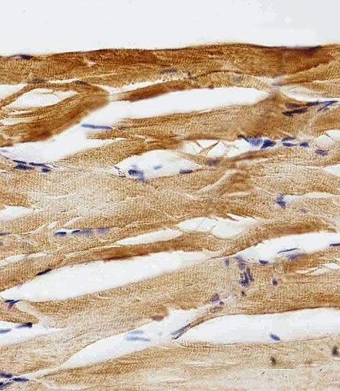 IHC-P