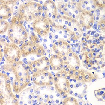 Immunohistochemistry - SHMT2 Polyclonal Antibody (144-01215)