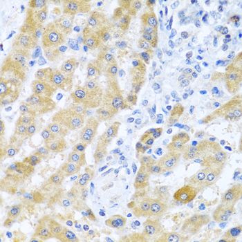 Immunohistochemistry - Gm13125 antibody (144-08095)