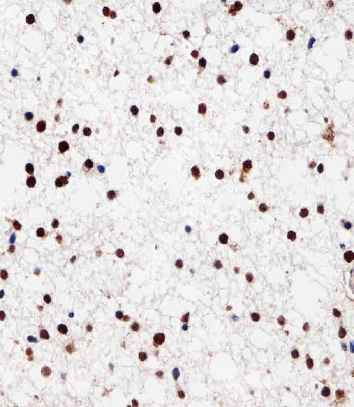 IHC-P