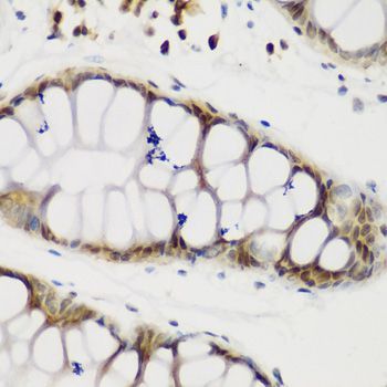 Immunohistochemistry - NCL Polyclonal Antibody (144-05904)