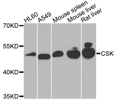 Western blot - [KO Validated] CSK Polyclonal Antibody (144-00735)