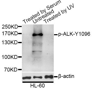 Western blot - Phospho-ALK-Y1096 antibody (144-50503)
