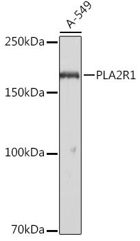 Western blot - PLA2R1 Polyclonal Antibody (144-10068)