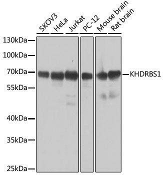 Western blot - KHDRBS1 antibody (144-06101)