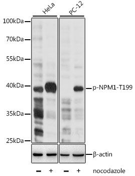 Western blot - Phospho-NPM1-T199 antibody (144-61545)