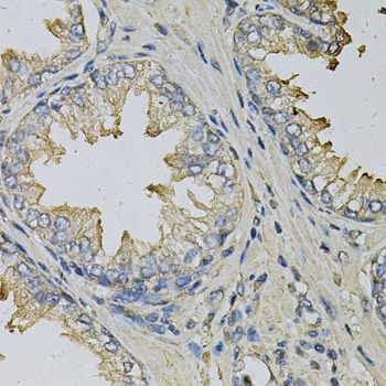 Immunohistochemistry - LITAF Polyclonal Antibody (144-05469)