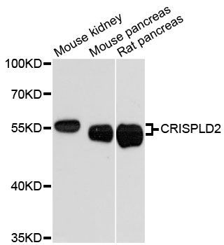 Western blot - CRISPLD2 antibody (144-60231)