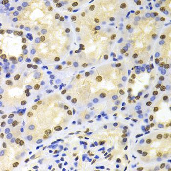 Immunohistochemistry - HDGF Antibody (144-05347)
