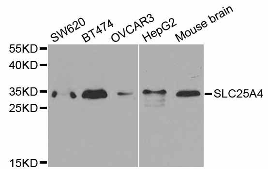 Western blot - SLC25A4 Polyclonal Antibody (144-01882)