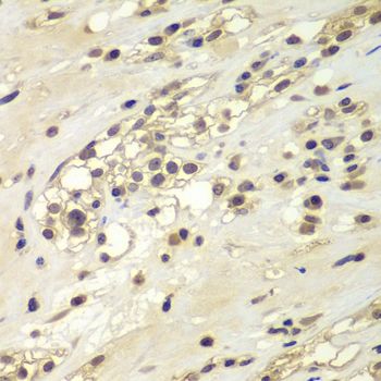 Immunohistochemistry - CHEK1 Polyclonal Antibody (144-07653)