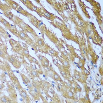 Immunohistochemistry - IGF2BP3 Polyclonal Antibody (144-02750)