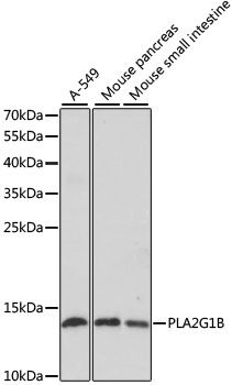 Western blot - PLA2G1B antibody (144-61418)