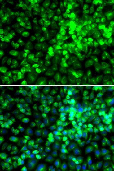Immunofluorescence - EIF2AK4 antibody (144-12618)