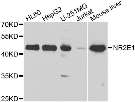 Western blot - NR2E1 Polyclonal Antibody (144-07455)