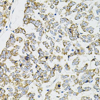Immunohistochemistry - PPP1CA Polyclonal Antibody (144-12468)