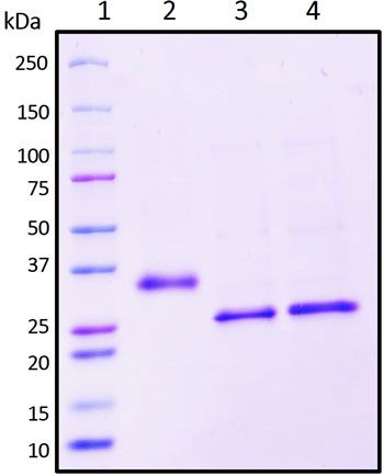 SDS-PAGE