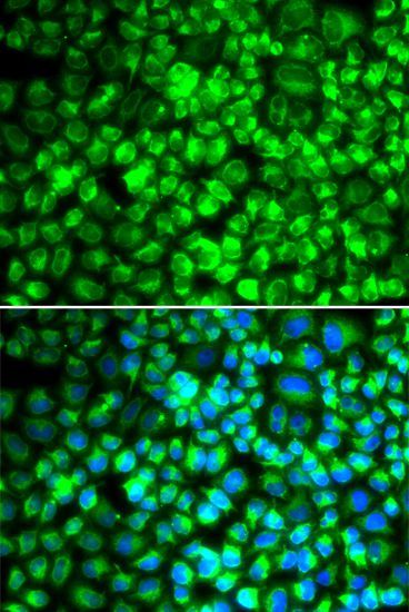 Immunohistochemistry - ATP5A1 Polyclonal Antibody (144-05884)