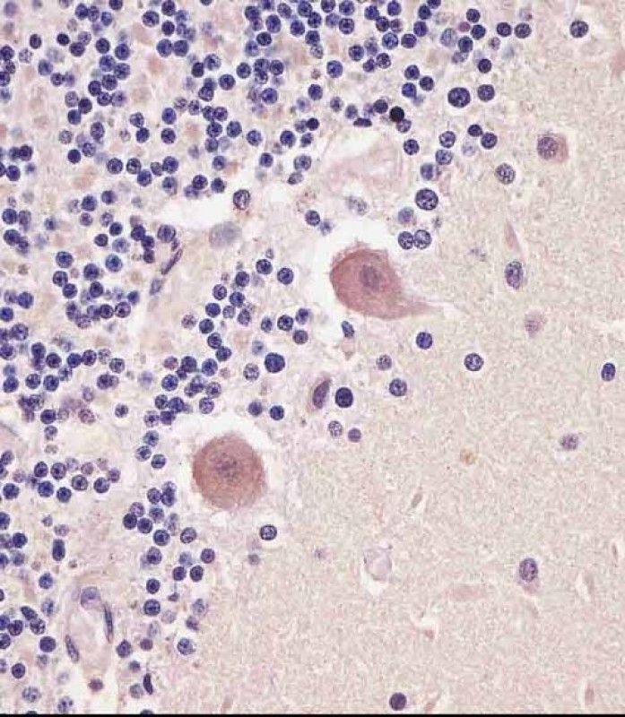 IHC-P