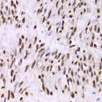 Immunohistochemistry - XRCC6 Polyclonal Antibody (144-00883)