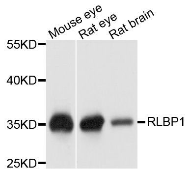 Western blot - RLBP1 antibody (144-09094)