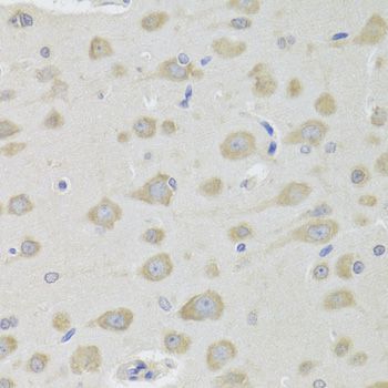 Immunohistochemistry - DHRS9 Polyclonal Antibody (144-06324)