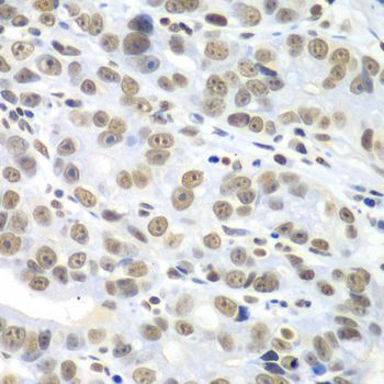 Immunohistochemistry - HDAC2 Polyclonal Antibody (144-02084)