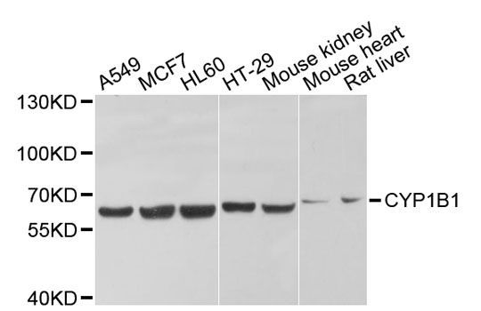 Western blot - CYP1B1 Polyclonal Antibody (144-01377)