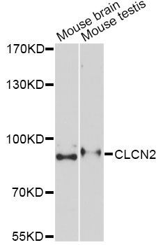 Western blot - CLCN2 Antibody (144-06120)