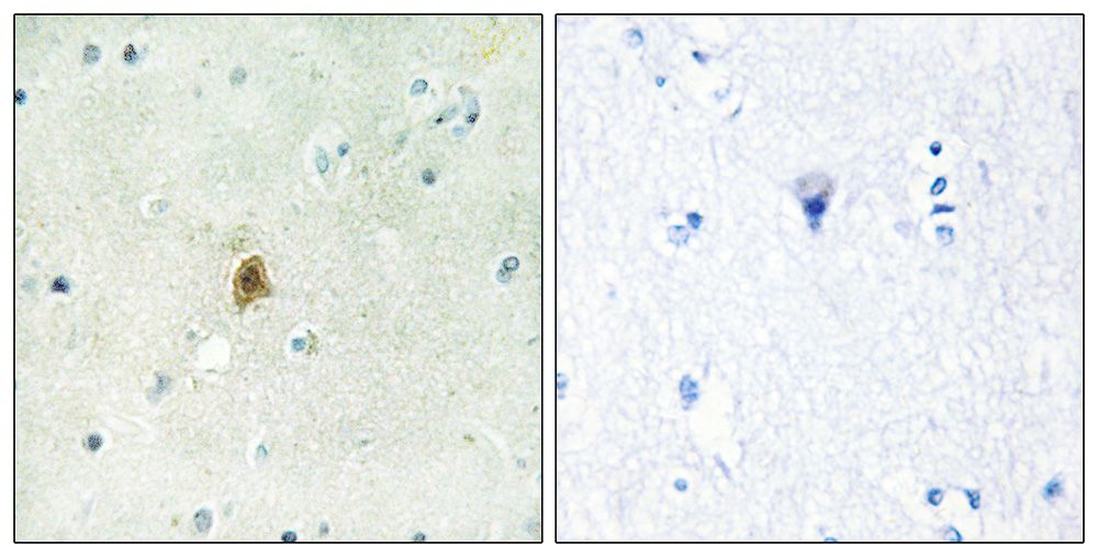 IHC