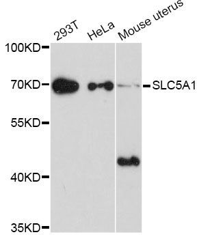 Western blot - SLC5A1 Antibody (144-600776)