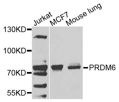 Western blot - PRDM6 antibody (144-07846)