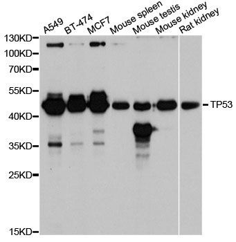 Western blot - TP53 Polyclonal Antibody (144-05761)