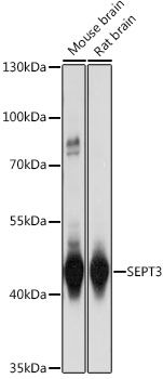 Western blot