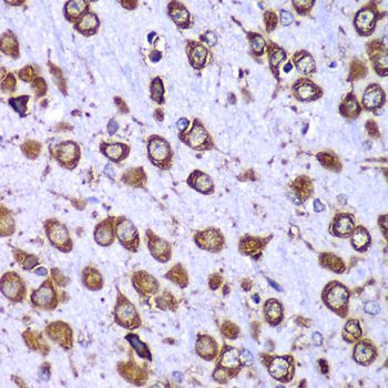 Immunohistochemistry - RPS10 antibody (144-06056)