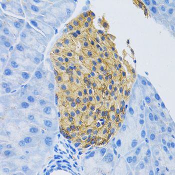 Immunohistochemistry - SLC1A2 Polyclonal Antibody (144-00910)