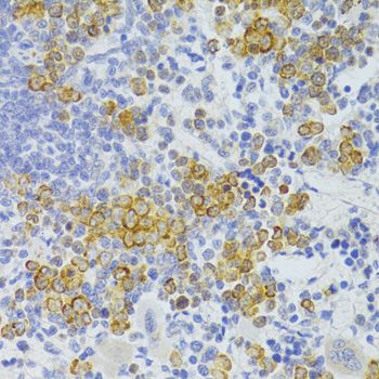 Immunohistochemistry - FAS Polyclonal Antibody (144-00233)