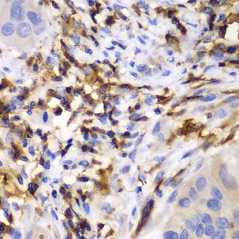 Immunohistochemistry - HCLS1 antibody (144-02165)