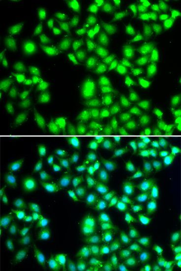 Immunofluorescence - YTHDC1 Polyclonal Antibody (144-07318)