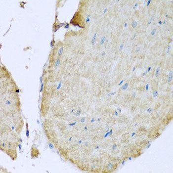 Immunohistochemistry - TMEM173 Polyclonal Antibody (144-03575)