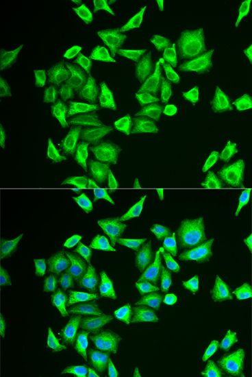 Immunofluorescence - PGM1 antibody (144-06303)