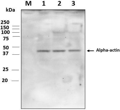 Western blot image