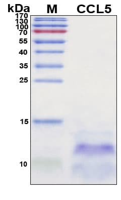 SDS-PAGE Image