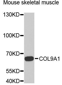 Western blot - COL9A1 antibody (144-06563)