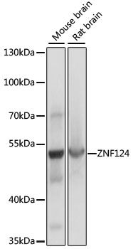 Western blot - ZNF124 antibody (144-60920)